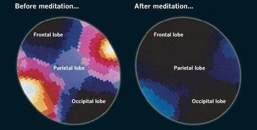 اسکن مغز قبل و بعد از مدیتیشن